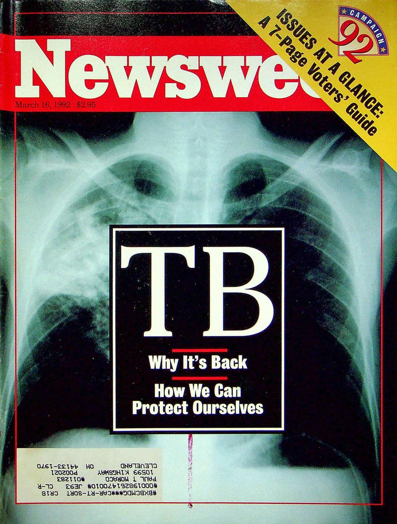 Newsweek Magazine March 16 1992 Turberculosis Back Public Health John Frohnmayer 1